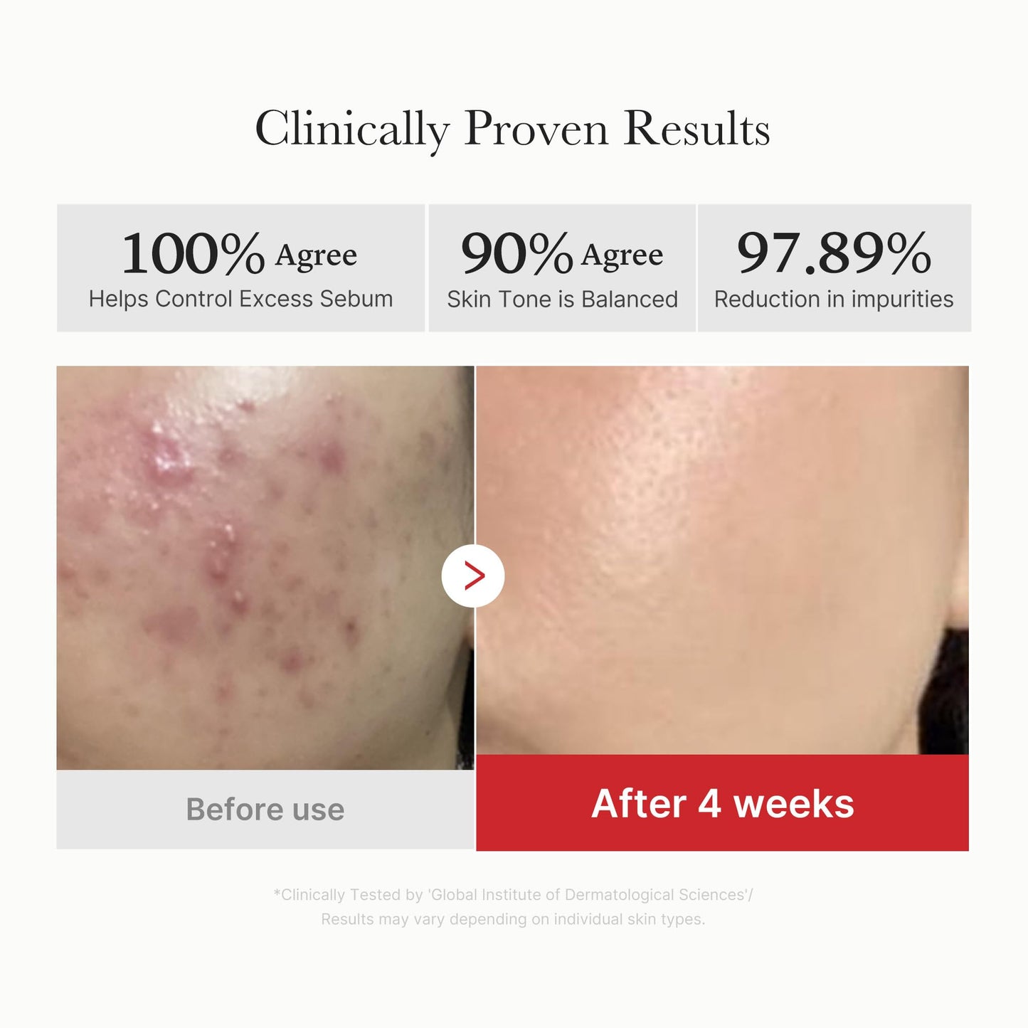 medicube Toner Pads Zero Pore Pad 2.0 | Dual-Textured Facial Pad for Exfoliation and Pore Care with 4.5% AHA Lactic Acid, 0.45% BHA Salicylic Acid | Ideal for All, Korean Skin Care, 70 Pads (1 Pack)